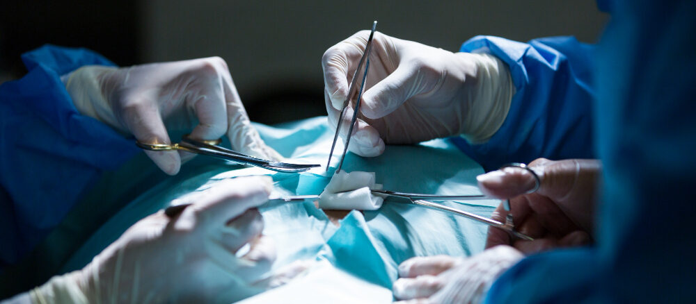 Laparoscopic Surgery in Lucknow | D P Bora Hospital